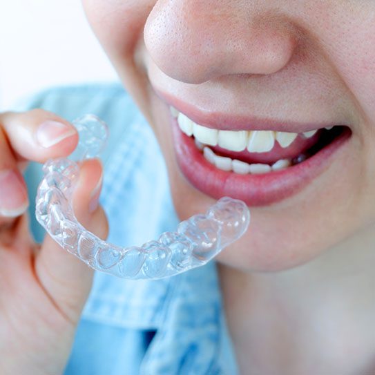 Eating and Drinking with Invisalign: Dos and Don’ts - MyOrthodontist - invisalign invisalign